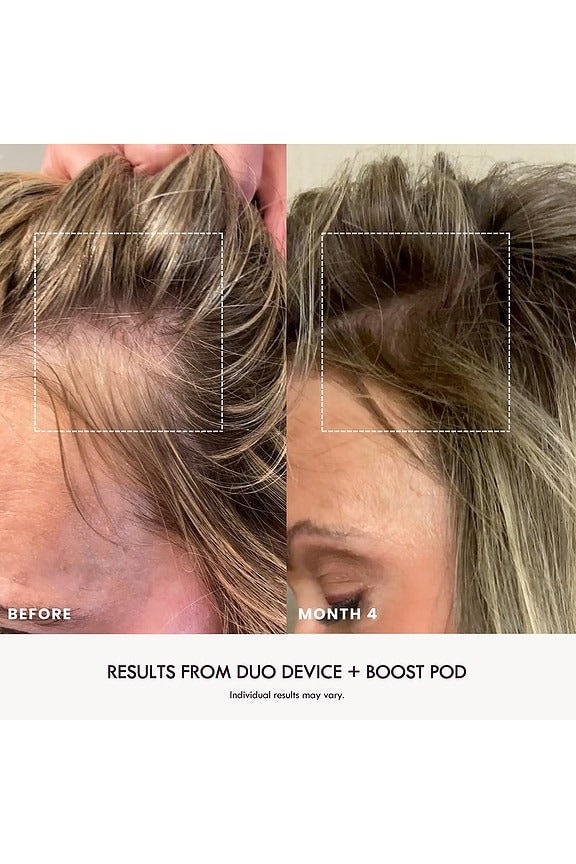 Boost Duo Pod Refills