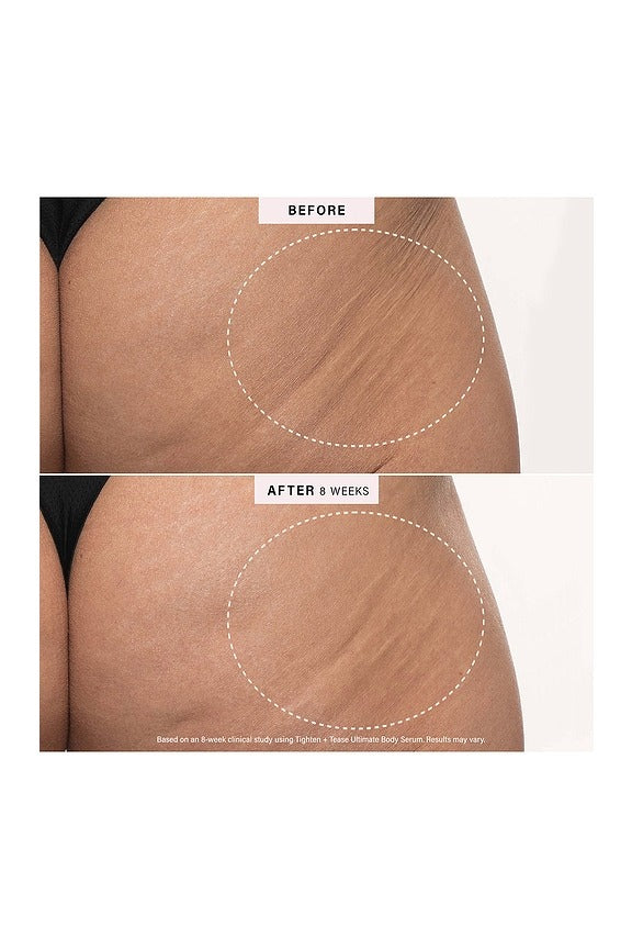 Body Discovery Trio
